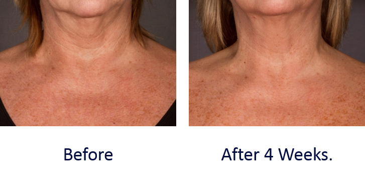 Pro-Collagen Neck and Decollete Balm